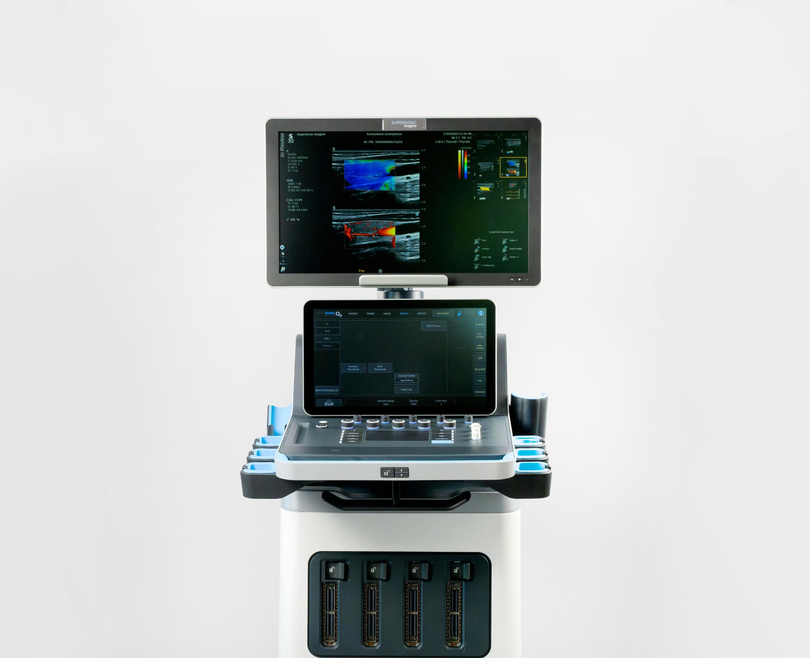 SuperSonic Ultrasound SuperSonic Ultrasound